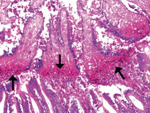 clostridium perfringens